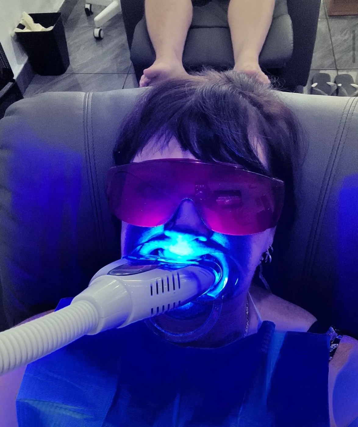 Bali Smile Teeth Whitening — photo 2